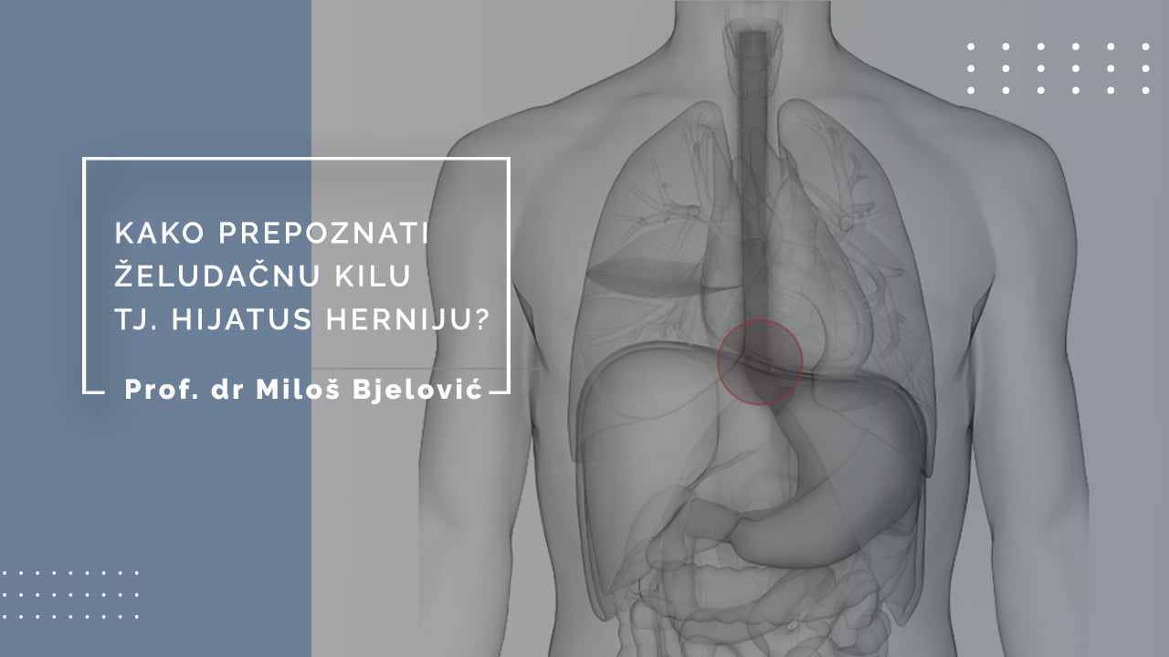 Hijatus Hernija - Kako prepoznati želudačnu kilu?